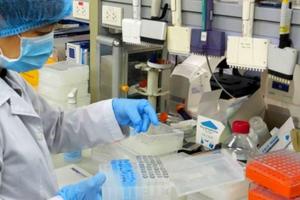 Không làm xét nghiệm virus SARS CoV-2 theo yêu cầu