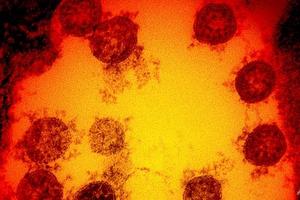 Phát hiện mới và sự thay đổi “chưa từng có” của biến chủng SARS-CoV-2