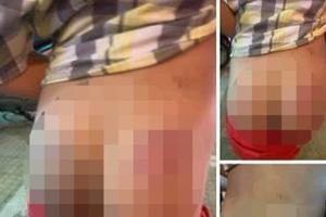 Kỷ luật cảnh cáo giáo viên đánh học sinh tiểu học