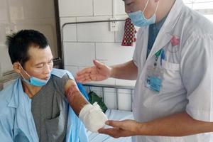 Điều trị rắn cắn không đúng cách, một bệnh nhân bị cắt bỏ nửa cánh tay