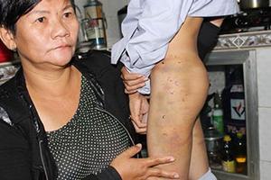 Vụ hai chú tiểu bị bạo hành: Đào hố sẵn dọa chôn sống nếu khai báo
