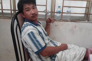 Bé 6 tuổi bị cha dượng đánh nứt hộp sọ