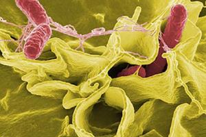 Nhiễm khuẩn, nhiễm độc thức ăn do Salmonella