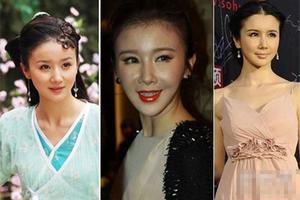 16 Sao nữ mặt méo mó, cứng đơ vì 'dao kéo'