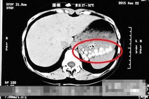 Trân châu trà sữa Trung Quốc bị nghi làm từ lốp xe, đế giày