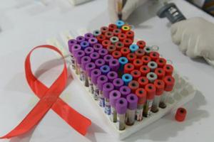 Hy vọng mới cho bệnh nhân nhiễm HIV