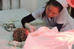 Bé trai 13 tháng tuổi làm đổ xăng, 2 mẹ con bỏng nặng