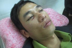 Kiểm lâm bị lâm tặc hành hung dã man