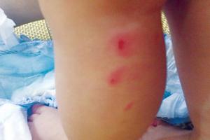 Đình chỉ 3 cơ sở mầm non bạo hành trẻ