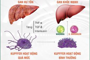 Suy gan - "Kẻ nổi loạn" nguy hiểm và không hề có điểm dừng