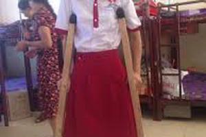 Kết luận chính thức nguyên nhân khiến Hà Vi bị cưa chân