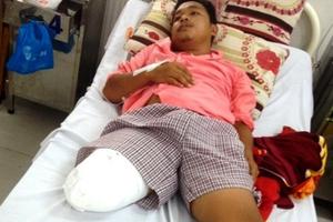 Cầu cứu Bộ trưởng Y tế khi bị cưa chân do BS chẩn đoán sai