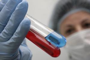 Quy định việc thanh toán và hỗ trợ thuốc kháng virus HIV
