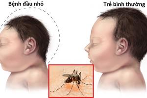 Nguy cơ bùng phát dịch Zika 
