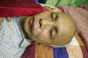 Cần sớm làm rõ việc công dân đang họp bị đánh nhập viện