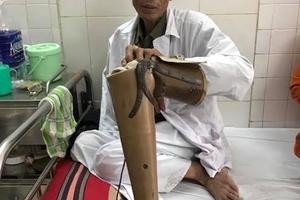 Khởi tố hình sự vụ cựu chiến binh bị hành hung ở Chương Mỹ