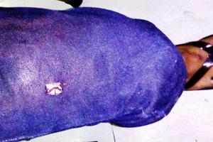 CA nổ súng chặn xe thuốc lậu, 1 người tử vong nghi do trúng đạn
