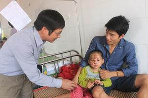 Thanh Hóa: Điều trị miễn phí cho bệnh nhi người Lào bị bỏng nặng