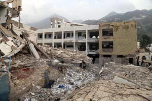 Dịch tả khiến hơn 100 người tử vong trong 2 tuần tại Yemen