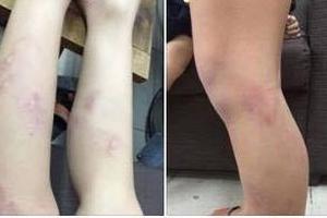 Chủ tịch HN: Làm rõ vụ 11 học sinh lớp 2 bị giáo viên bạo hành