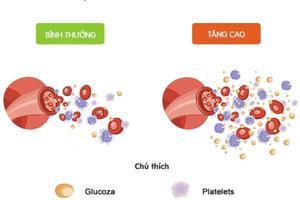 Những lưu ý trong chế độ ăn uống của người bị đái tháo đường