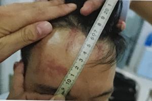 Có dấu hiệu vi phạm tố tụng trong giải quyết vụ án