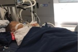 Nhiều trẻ nhập viện trong tình trạng suy phủ tạng do bị ong đốt