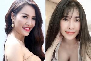 Giật mình hình ảnh phẫu thuật thẩm mỹ băng bó chằng chịt của sao Việt