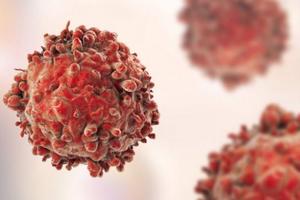 Cách đơn giản giúp gia tăng cơ hội sống sót cho trẻ bị ung thư máu