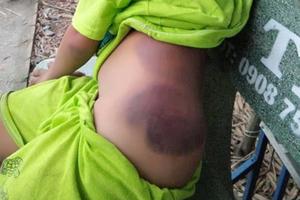 Bộ Giáo dục-Đào tạo yêu cầu xác minh việc học sinh ở Long An bị đánh