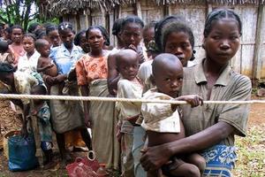 Madagascar: Gần 1.000 trẻ em tử vong vì bệnh sởi chỉ trong 4 tháng