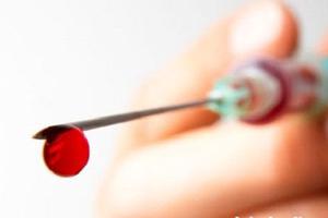 1.200 trẻ em Mỹ có thể phơi nhiễm HIV và viêm gan vì khám nha khoa