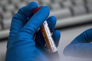 Châu Âu mở chiến dịch chống doping quy mô lớn, bắt giữ nhiều đối tượng