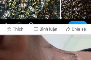 Xuất hiện tình trạng thương lái Trung Quốc thu mua bọ lạ có độc