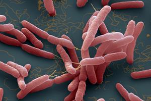 4 bệnh nhân BV Bạch Mai tử vong do whitmore, những dấu hiệu cần biết