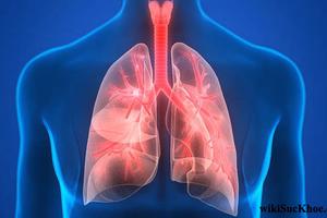 Không để dịch bệnh viêm phổi tại Trung Quốc xâm nhập vào nước ta