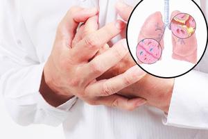 Chưa xác định nguyên nhân cụ thể gây bệnh viêm phổi cấp tại Trung Quốc