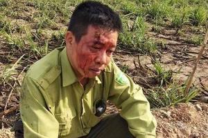 Tạm giam một đối tượng chống người thi hành công vụ