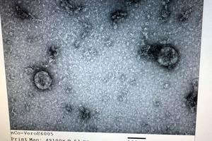 Việt Nam nuôi cấy và phân lập thành công virus Corona mới