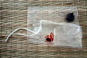 Bệnh viện Đa khoa Trí Đức Thành bị tố mổ “phá nát” bàng quang mà không lấy được sỏi