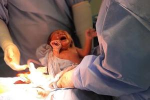 Mổ thành công cho sản phụ về từ vùng dịch không khai báo y tế