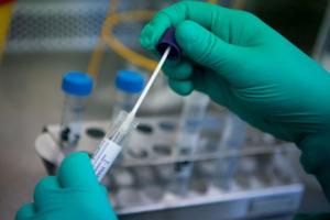 TPHCM chuẩn bị 50.000 bộ kit xét nghiệm Covid-19 trên diện rộng