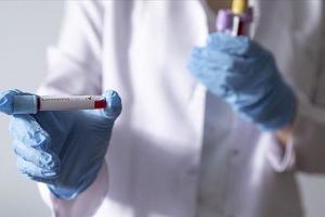 Lực lượng y tế Zimbabwe đình công trong bối cảnh COVID-19