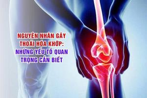 Nguyên nhân gây thoái hóa khớp: Những yếu tố quan trọng cần biết