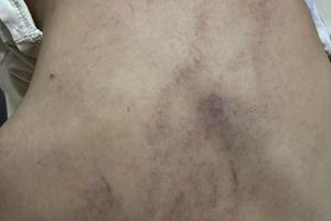 Cục Bà mẹ và Trẻ em báo cáo nhanh về vụ trẻ bị bạo hành ở Trường mầm non Gia Thụy