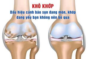 Khô khớp: Dấu hiệu cảnh báo sụn đang mòn, khớp đang yếu bạn không nên bỏ qua