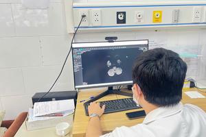 Thiếu niên tổn thương não vì ngộ độc thuốc lá điện tử chứa ma túy