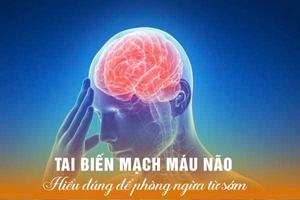 Hiểu đúng về tai biến mạch máu não để phòng ngừa từ sớm