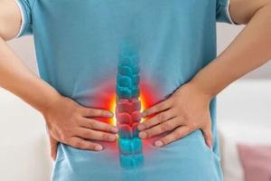 Thoát vị đĩa đệm ở người trẻ, chớ chủ quan