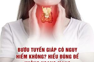 Bướu tuyến giáp có nguy hiểm không?